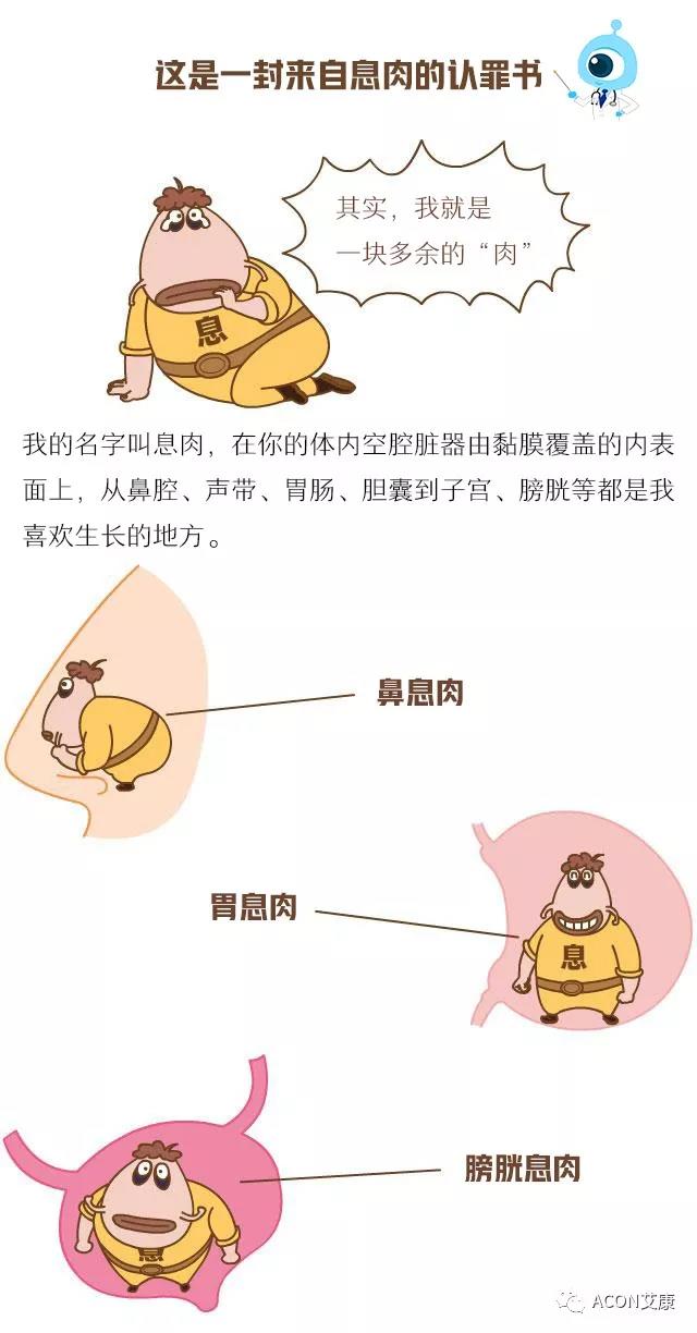 “艾”漫畫 | 這是一封來(lái)自息肉的《認(rèn)罪書(shū)》