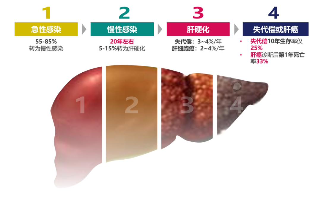 悄悄變成肝硬化、肝癌，很多人感染了卻不知道